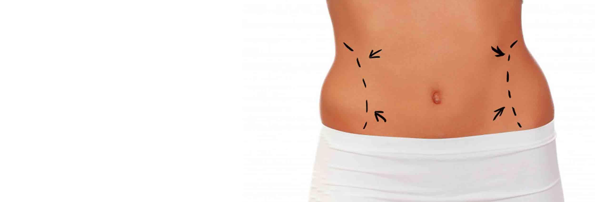 Chirurgie Plastique Abdominale En Tunisie Lifting Ventre Apres Grossesse